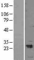 Myosin light chain 3 (MYL3) Human Over-expression Lysate