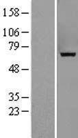 MTM1 Human Over-expression Lysate