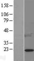 Leptin (LEP) Human Over-expression Lysate