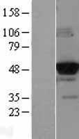 Glucokinase (GCK) Human Over-expression Lysate