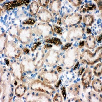 SLC12A1 Rabbit Polyclonal Antibody