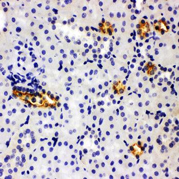 SLC12A1 Rabbit Polyclonal Antibody