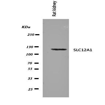 SLC12A1 Rabbit Polyclonal Antibody