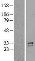 CD40L (CD40LG) Human Over-expression Lysate