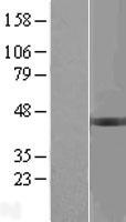 BCKDHB Human Over-expression Lysate