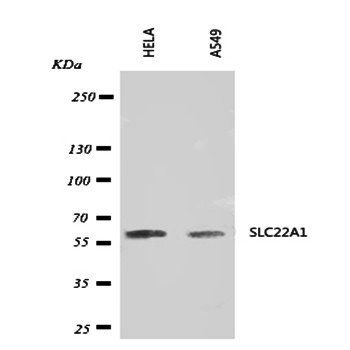 SLC22A1 Rabbit Polyclonal Antibody