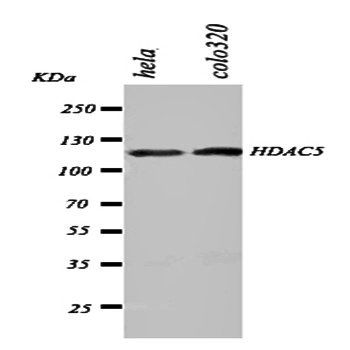 Histone deacetylase 5 HDAC5 Rabbit Polyclonal Antibody