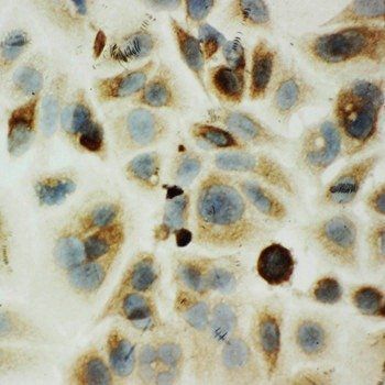 Hyaluronidase-1 HYAL1 Rabbit Polyclonal Antibody