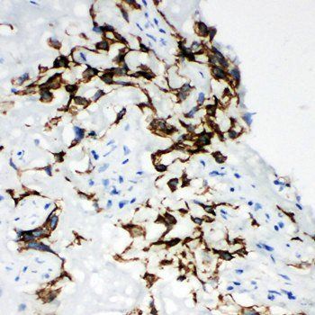 Hyaluronidase-1 HYAL1 Rabbit Polyclonal Antibody