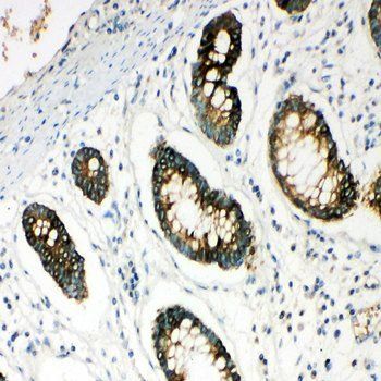 Hyaluronidase-1 HYAL1 Rabbit Polyclonal Antibody