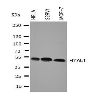 Hyaluronidase-1 HYAL1 Rabbit Polyclonal Antibody