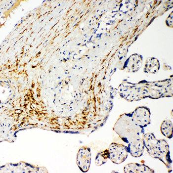 Monocarboxylate transporter 5 SLC16A4 Rabbit Polyclonal Antibody