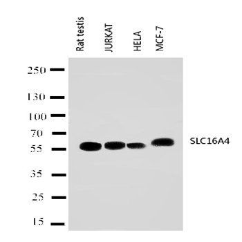 Monocarboxylate transporter 5 SLC16A4 Rabbit Polyclonal Antibody