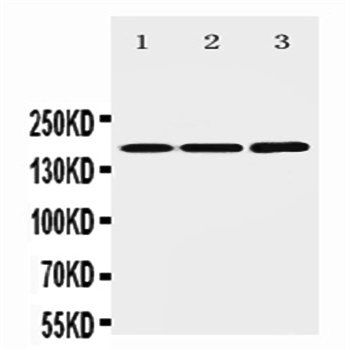 NMDAR2B/GRIN2B Rabbit Polyclonal Antibody