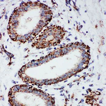 MTCO1/MT-CO1/MT Rabbit Polyclonal Antibody
