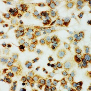 MTCO1/mt-Co1 Rabbit Polyclonal Antibody