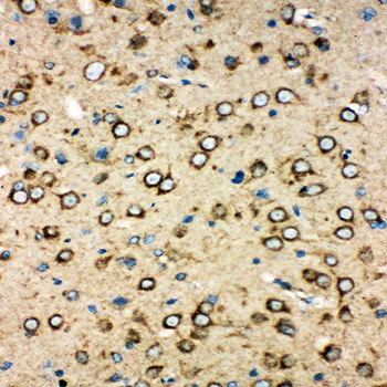 MTCO1/mt-Co1 Rabbit Polyclonal Antibody