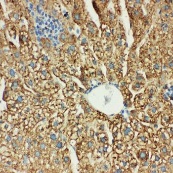 MTCO1/mt-Co1 Rabbit Polyclonal Antibody