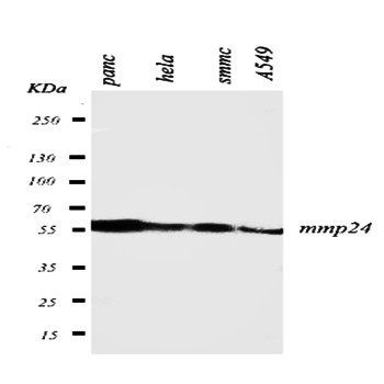 Matrix metalloproteinase-24 MMP24/24 Rabbit Polyclonal Antibody