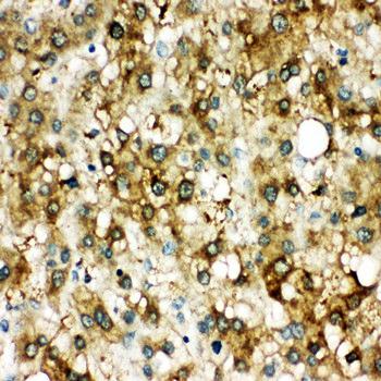 AACT/SERPINA3 Rabbit Polyclonal Antibody