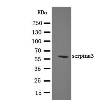 AACT/SERPINA3 Rabbit Polyclonal Antibody
