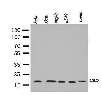 Diubiquitin/UBD Rabbit Polyclonal Antibody
