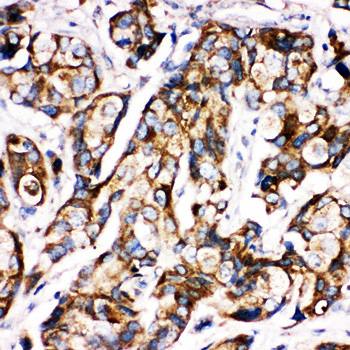 Sonic Hedgehog/SHH Rabbit Polyclonal Antibody