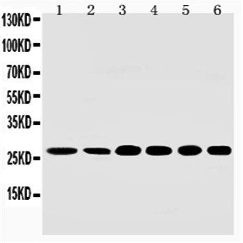 Sonic Hedgehog/SHH Rabbit Polyclonal Antibody