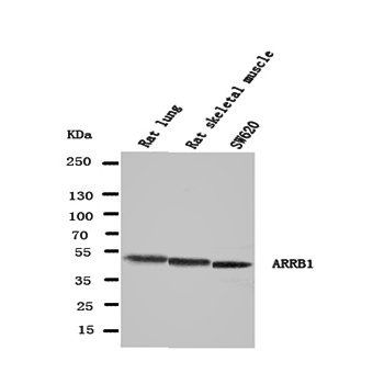 beta Arrestin 1/ARRB1 Rabbit Polyclonal Antibody