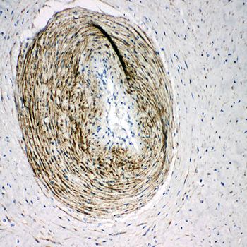 Calponin/CNN1 Rabbit Polyclonal Antibody