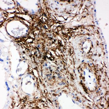 Phospholipid transfer protein PLTP Rabbit Polyclonal Antibody