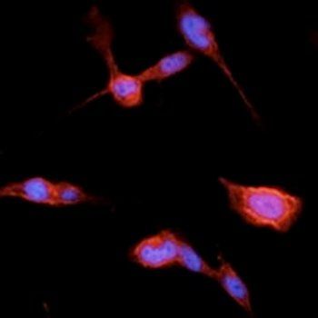 beta-Catenin Antibody