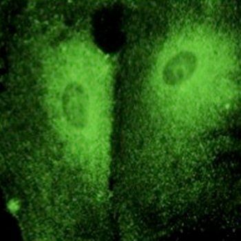 RAB27, member RAS oncogene family Antibody