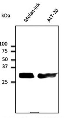 RAB27, member RAS oncogene family Antibody