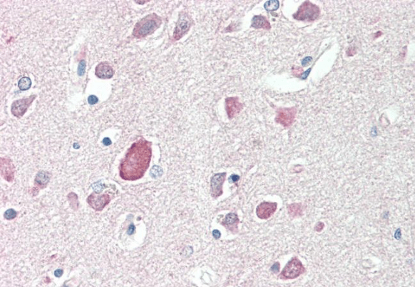 Goat anti-PTGDS Antibody