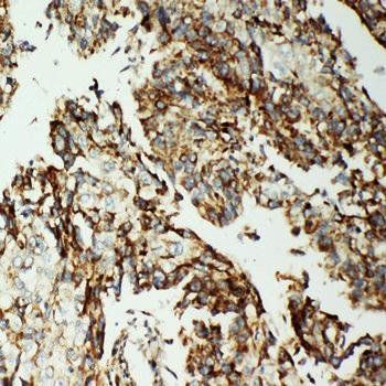 AIF/AIFM1 Rabbit Polyclonal Antibody