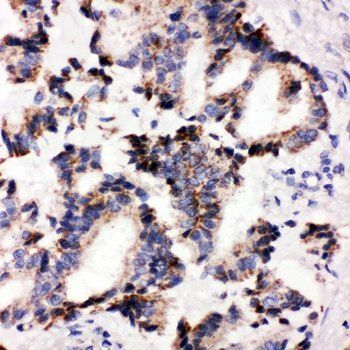 IRAK2 Rabbit Polyclonal Antibody