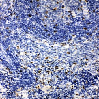 IRAK2 Rabbit Polyclonal Antibody