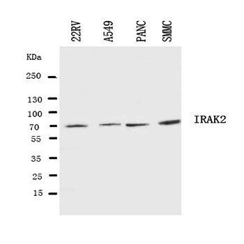 IRAK2 Rabbit Polyclonal Antibody