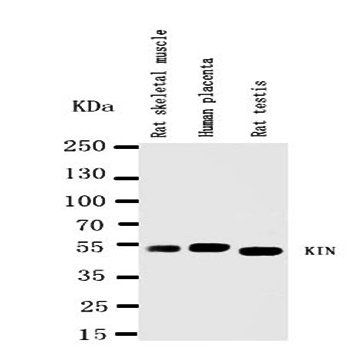 DNA/RNA-binding protein KIN17 KIN/RNA Rabbit Polyclonal Antibody