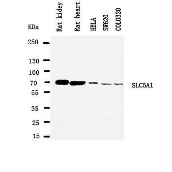 SGLT1/SLC5A1 Rabbit Polyclonal Antibody