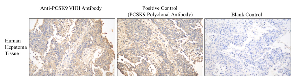 PCSK9 VHH antibody, clone LDL7