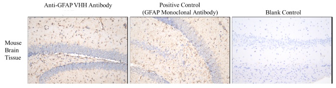 Human Glial Fibrillary Acidic Protein (GFAP) Antibody