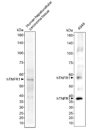 Human Tumor Necrosis Factor Receptor 1 (hTNFR1) Antibody