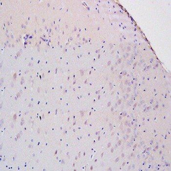 8-OHdG (DNA/RNA Damage) Rabbit Polyclonal Antibody (FITC)