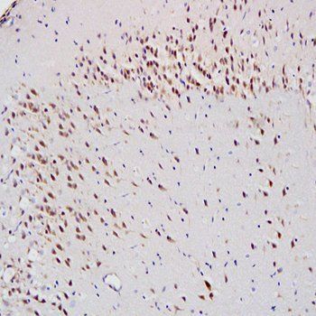 8-OHdG (DNA/RNA Damage) Rabbit Polyclonal Antibody (FITC)