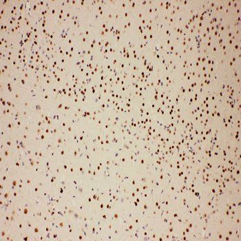 E3 SUMO-protein ligase PIAS1 PIAS1/SUMO Rabbit Polyclonal Antibody
