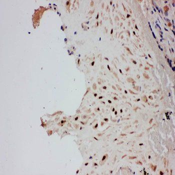 E3 SUMO-protein ligase PIAS1 PIAS1/SUMO Rabbit Polyclonal Antibody