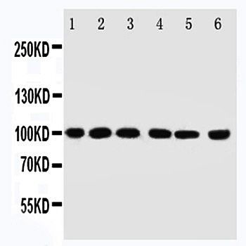 E3 SUMO-protein ligase PIAS1 PIAS1/SUMO Rabbit Polyclonal Antibody