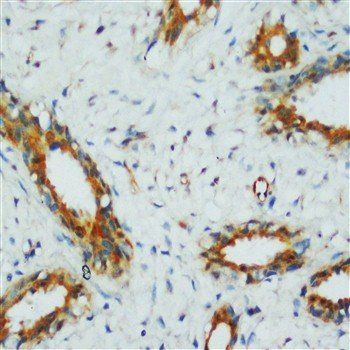 PP2A-alpha/PPP2CA/PP2A Rabbit Polyclonal Antibody